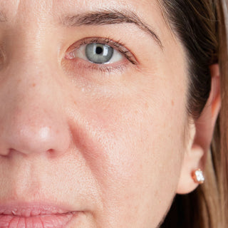 BTBS Dry Skin Regimen Page | B+A Tile 2 Image File [After]